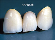 Load image into Gallery viewer, Soft diamond wheel