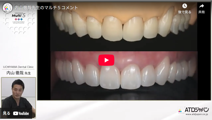 内山先生マルチ5臨床　動画
