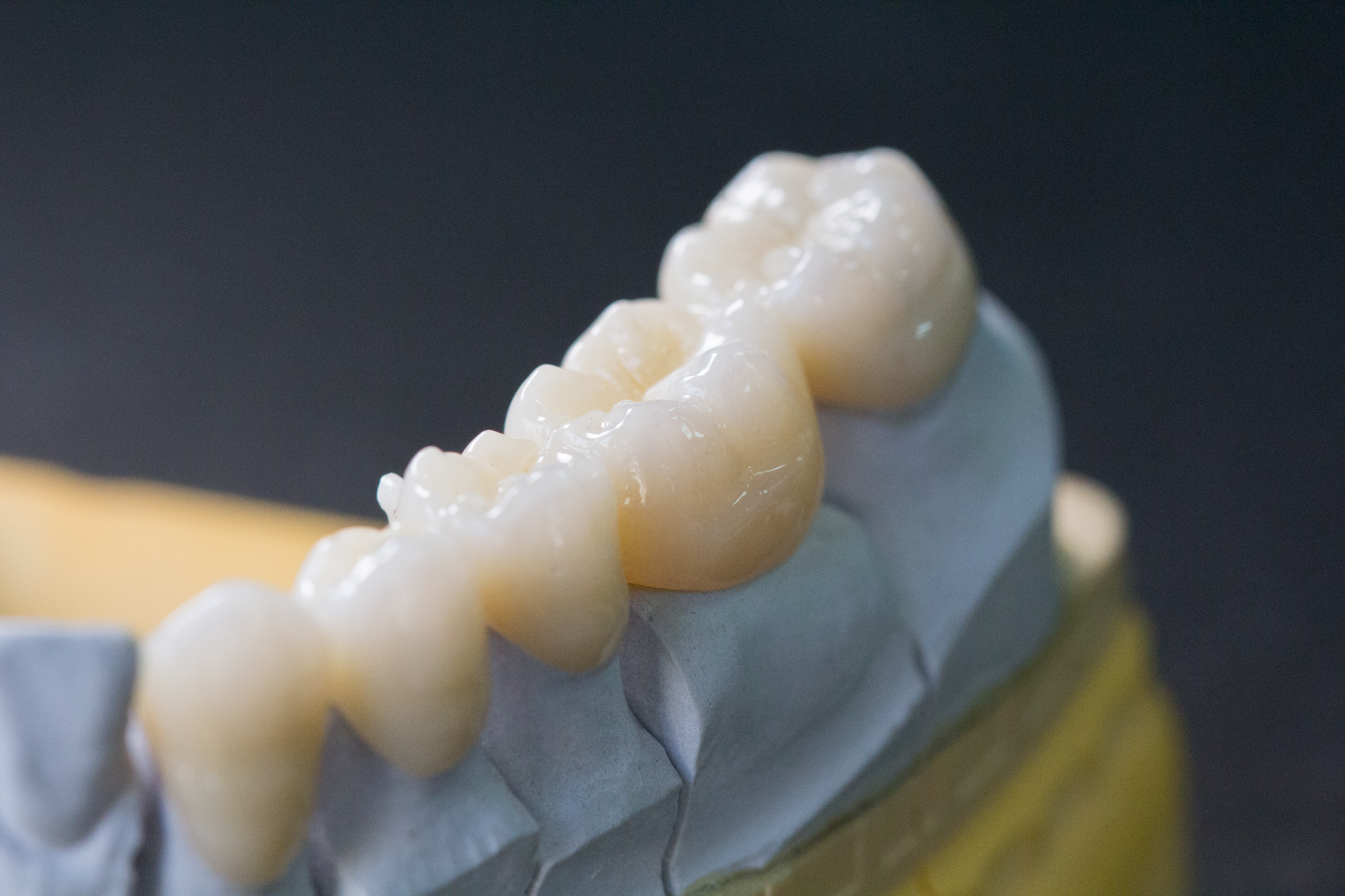 マルチ5(直径98mm) – エーティーディー・ジャパン